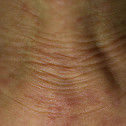 תמונה מוגדלת של קמטים בצוואר המראה את ההבדל במרקם העור